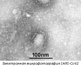 Электронная микрофотография SARS-CoV2