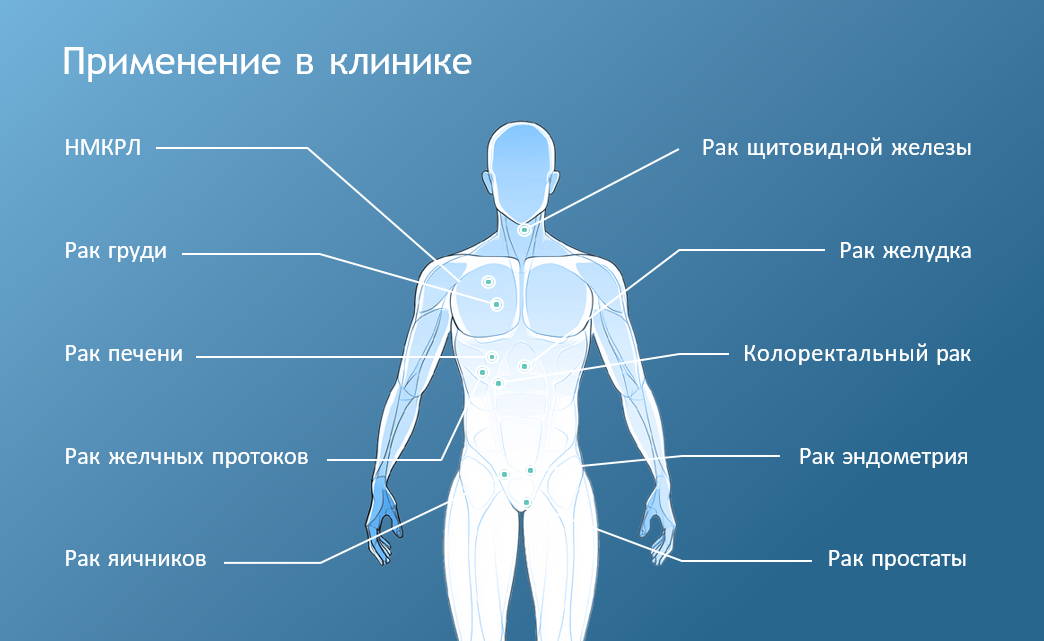 Photo_TrueSteady_Z-CAPTURE-Pan-Cancer-Use.png